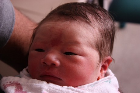 Maile at birth