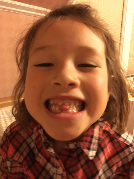 Oh yeah, and Maile lost tooth #2 (with an assist from Papa Mike)!